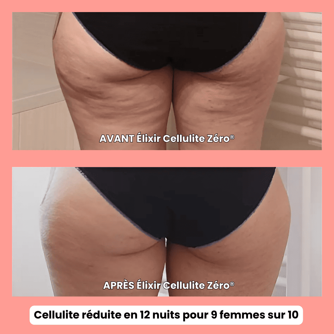 Cellulite Zéro®- Formule Nuit – Anti-Cellulite Tenace + Ultra Fermeté