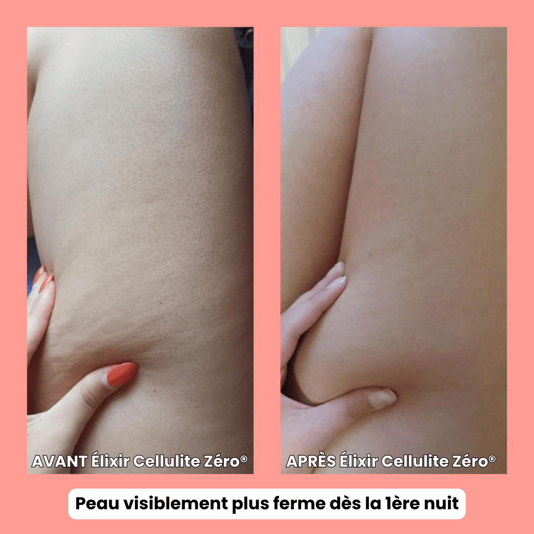 Cellulite Zéro®- Formule Nuit – Anti-Cellulite Tenace + Ultra Fermeté