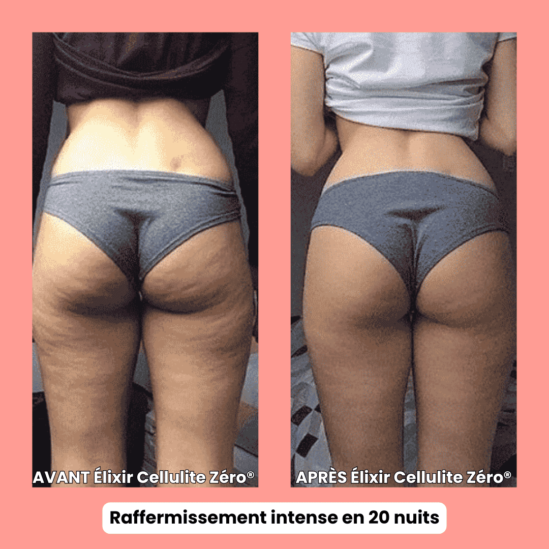 Cellulite Zéro®- Formule Nuit – Anti-Cellulite Tenace + Ultra Fermeté