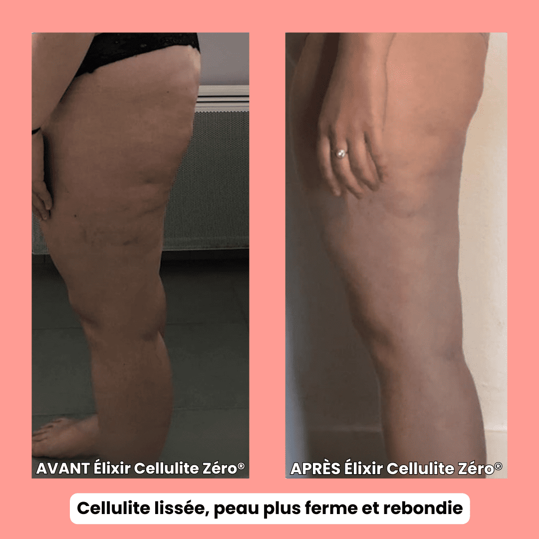 Cellulite Zéro®- Formule Nuit – Anti-Cellulite Tenace + Ultra Fermeté